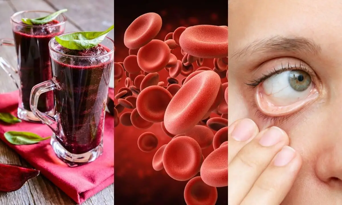 jugos para subir globulos rojos - Cómo aumentar los glóbulos rojos rápidamente
