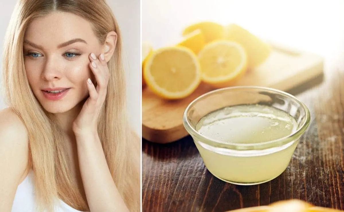 el jugo de limon sirve para las manchas dela cara - Cómo quitar las manchas de la cara de manera natural