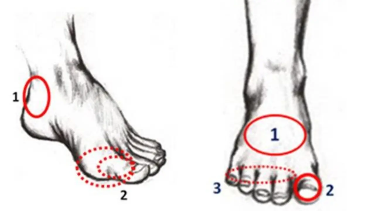 dolor de pies despues de jugar futbol - Qué hacer si te duelen los pies después de hacer ejercicio